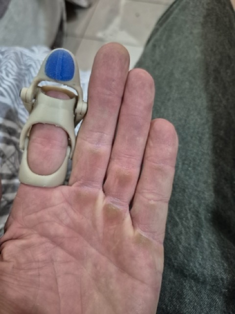 S.P. wearing the beige prototype, view from the side showing how it sits on the finger
